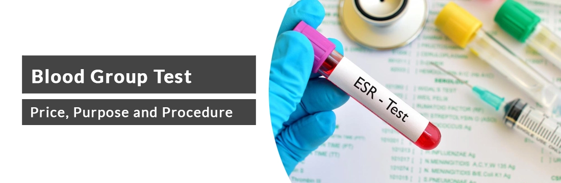 Erythrocyte Sedimentation Rate Test: Price Range and Procedure